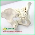 PELVIS03 (12340) Medical Anatomical Adult Female Pelvis Model, Anatomy Models > Male/Female Models
